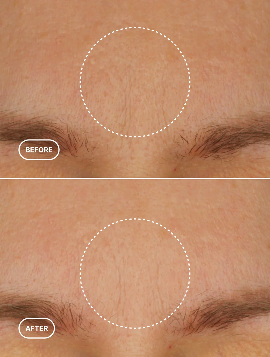 Retinol Moisturizer